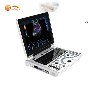 Laptop Obstetrícia &Ginecologia Ecograph Digital, Scanner De Ultra-Som Diagnóstico Do Sistema  5